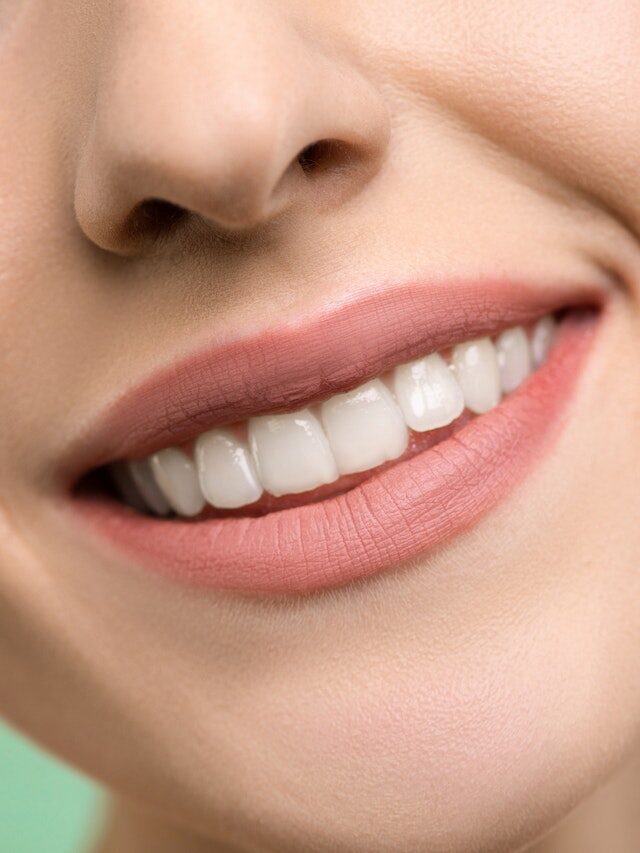 Best Teeth Whitening Products for a Brighter Smile