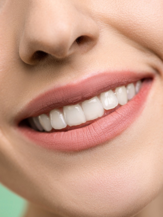 Best Teeth Whitening Products for a Brighter Smile