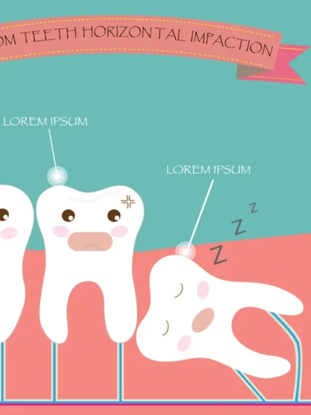 Types of Wisdom Teeth Extraction: Which Method is Best for You?